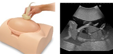 新規シミュレータ「胎児超音波診断ファントム」